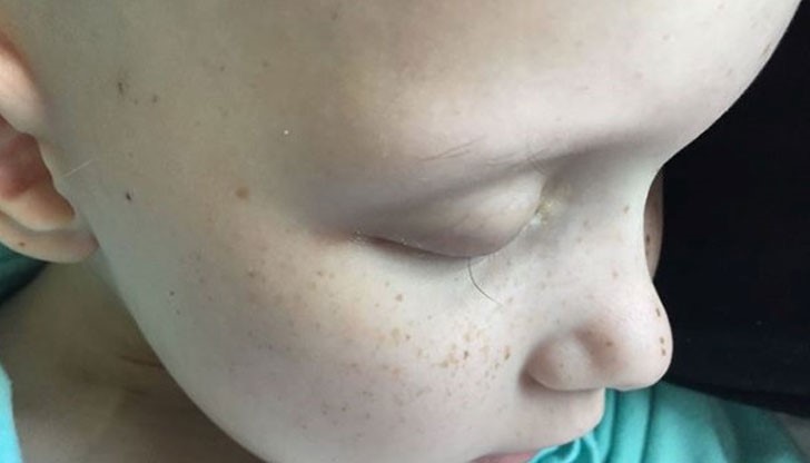 Хейли е болна от рак ,а снимката отразява всичко, през което трябвало да премине малкото момиченце