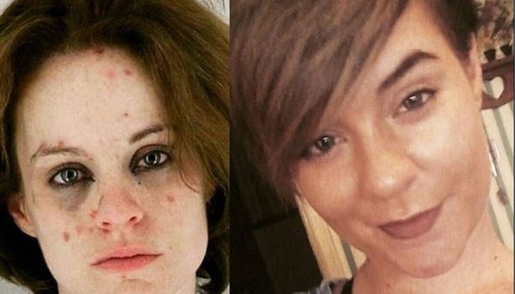 Жени се осмелиха да разкрият потресаващия си вид, докато са били наркозависими