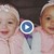 Жена роди близначки с различен цвят на кожата
