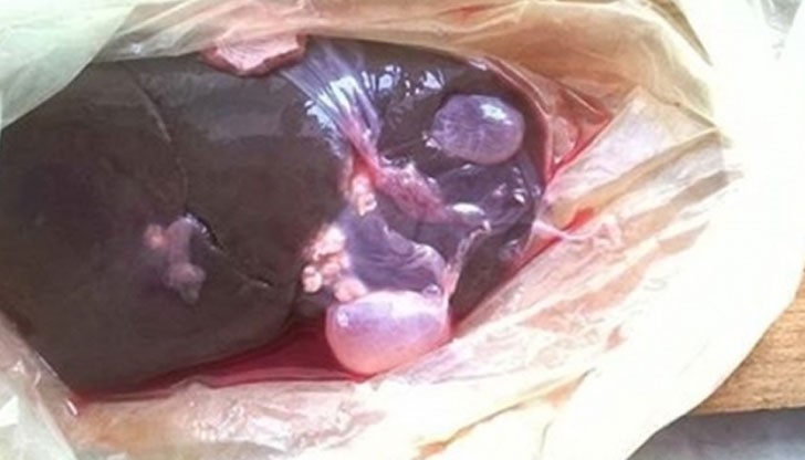 На опасната храна е попаднала млада ветеринарна лекарка