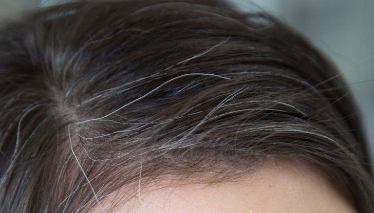 Преждевременното посивяване на косите прибавя към възрастта на хората около 5-10 години отгоре