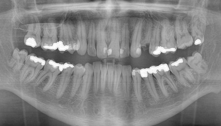Това е чудесно, защото кой обича да ходи на зъболекар? Това е чудесно, защото кой обича да ходи на зъболекар?
