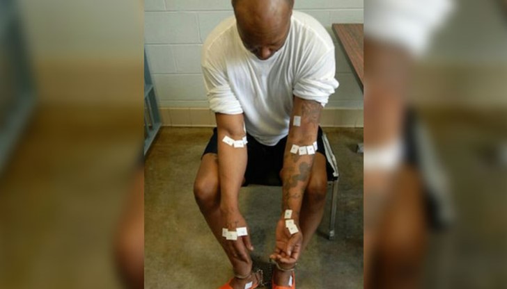 Пробождат десетки пъти тялото на Ромел Брум в опит да открият вена и да му поставят смъртоносната инжекция