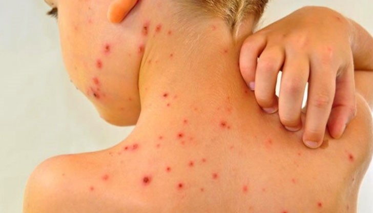 Момченцето е посещавало детска градина, цялата група е поставена под карантина / Снимката е илюстративна Момченцето е посещавало детска градина, цялата група е поставена под карантина / Снимката е илюстративна