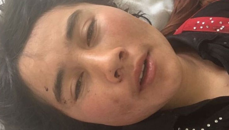 След нападението мъжът й избягал