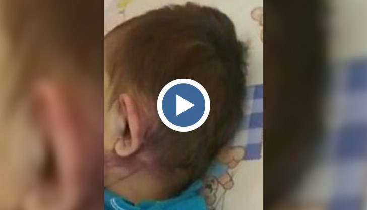 Адриана Иванова организира събиране на помощи за 2-годишния Васко от Ихтиман