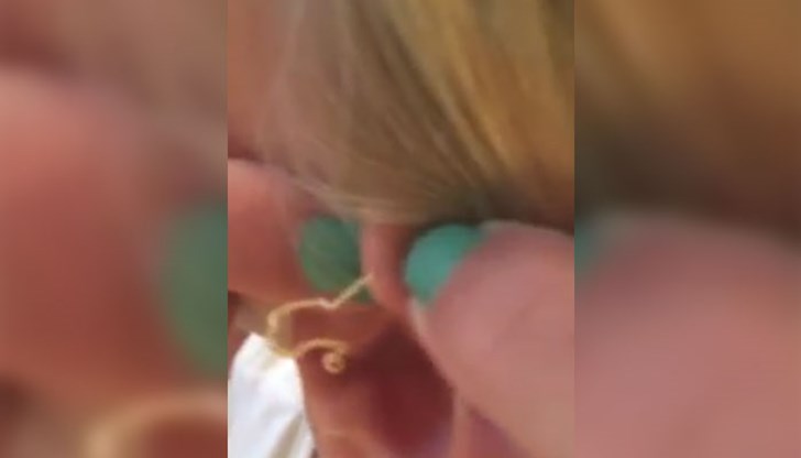 Не бързайте да стискате пъпките си