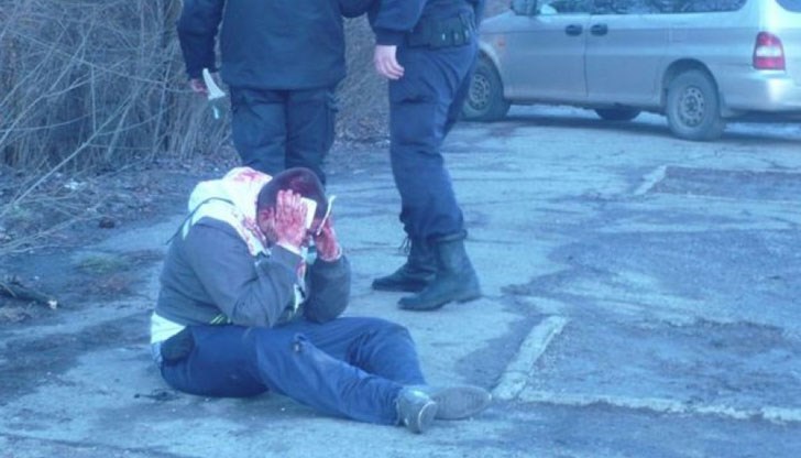 10 хиляди лева обещетение за отхапано ухо определи съдът в Смолян / Снимката е илюстративна 10 хиляди лева обещетение за отхапано ухо определи съдът в Смолян / Снимката е илюстративна