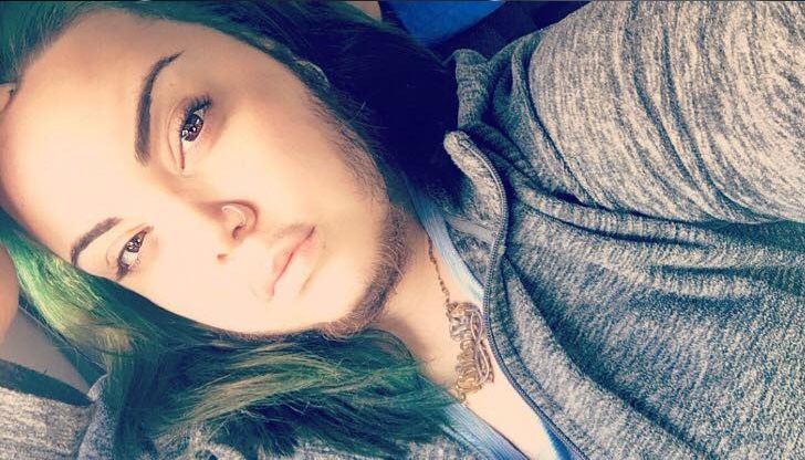 Момичето получава силна подкрепа от приятеля си, който не се притеснява от силното окосмяване по лицето й