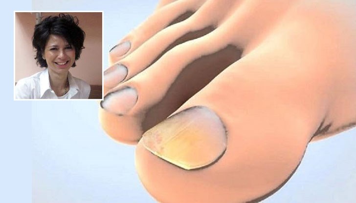 Гъбичките се срещат навсякъде, хранят се от кожата и космите ни Гъбичките се срещат навсякъде, хранят се от кожата и космите ни