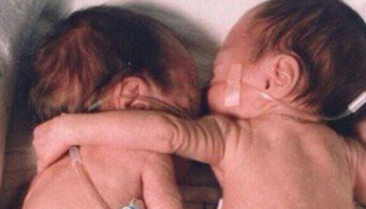 Кери и Бриел са чудо на медицината! Кери и Бриел са чудо на медицината!