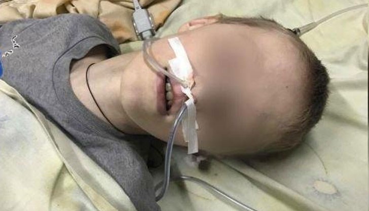 13-годишно момче има тежка травма на главата и е получило амнезия