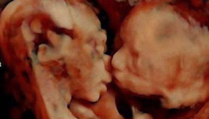 Уникален момент, заснет от ултразвук