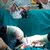 Пловдивски лекари спасиха жена със запушен бъбрек