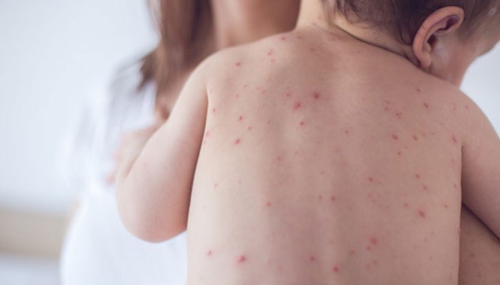 Освен в Пловдив и в Пазарджик, има и два доказани случая на заразяване и в Монтана