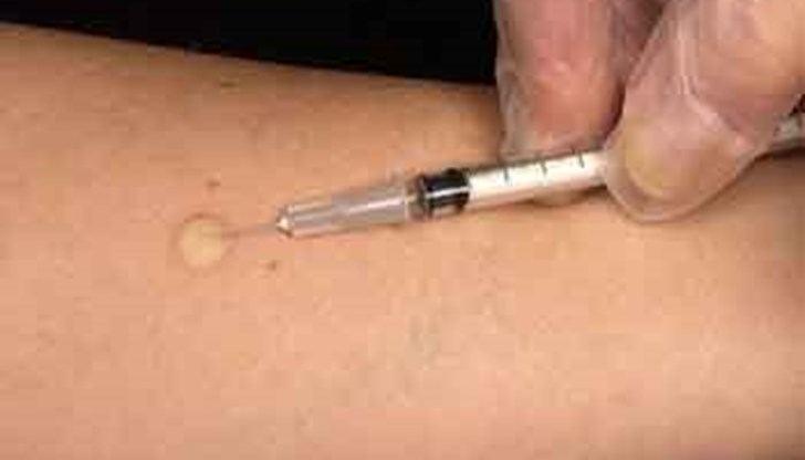 Реимунизацията срещу туберкулоза вече не е задължителна