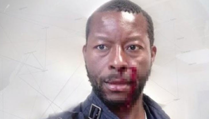 Предполага се, че е атакуван само заради това, че е цветнокож