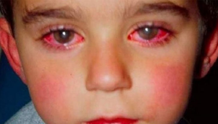 15-годишно момче загубва част от зрението си при игра със закупен от Интернет лазерен показалец / Снимката е илюстративна