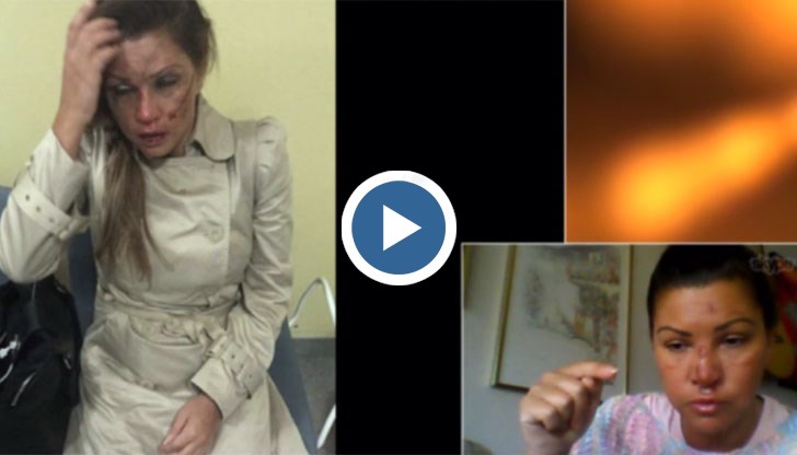 Сани Алекса разкрива, че е била пребивана системно