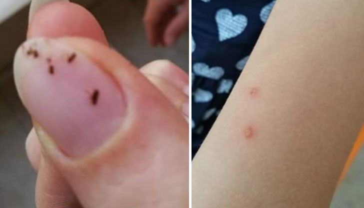 Смачканите бълхи изпаднаха от чорапките на детето...