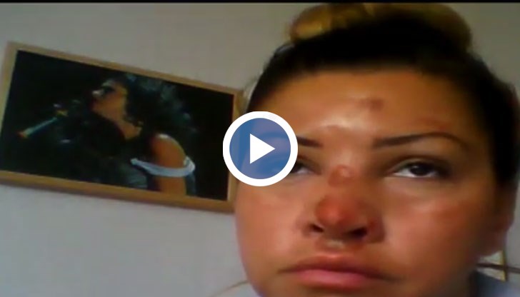 Преби ме преди 2-3 месеца, но отново се върнах при него