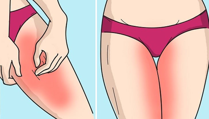 Използвайте тези хитринки, за да се наслаждавате без болка на разходките по морския бряг Използвайте тези хитринки, за да се наслаждавате без болка на разходките по морския бряг