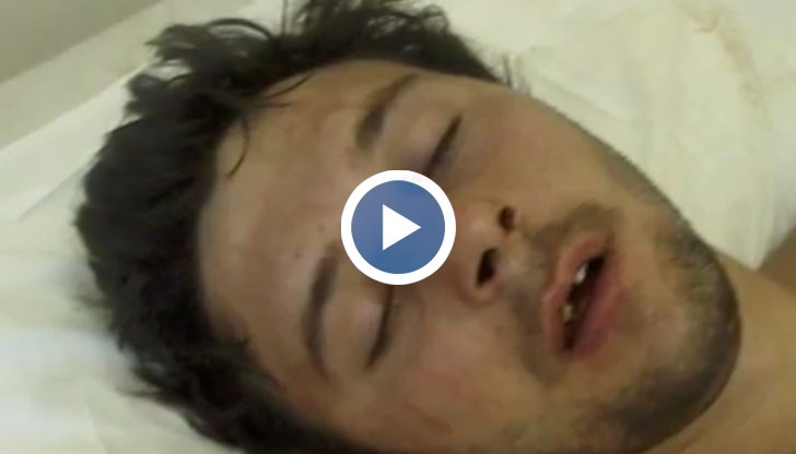 След нелепата смърт на 17-годишния Алекс от Бяла заради една цигара, едно момче от Смолян с подобна история успя да се справи с тежките физически травми