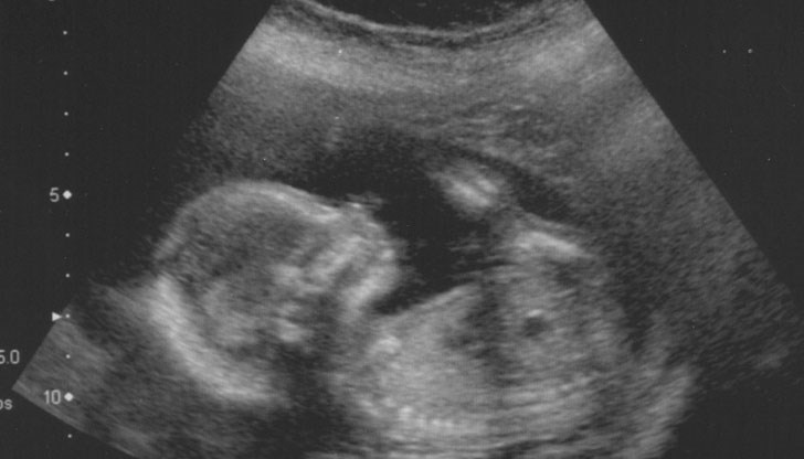 Вие замисляте ли се изобщо, преди да попитате Кога най-после ще имате дете?