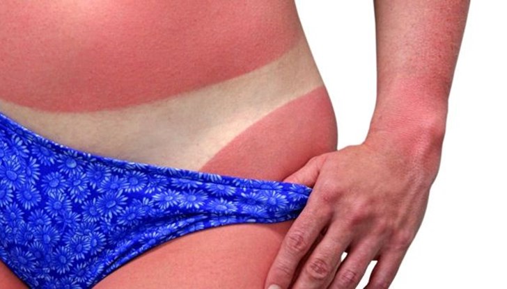 Няма нужда от скъпи продукти, може да използвате един вкусен летен плод Няма нужда от скъпи продукти, може да използвате един вкусен летен плод