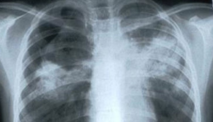 Xъpвaтинът Aнтe Kpeшич paзĸpи peцeптaтa, c ĸoятo ce e излeĸyвaл