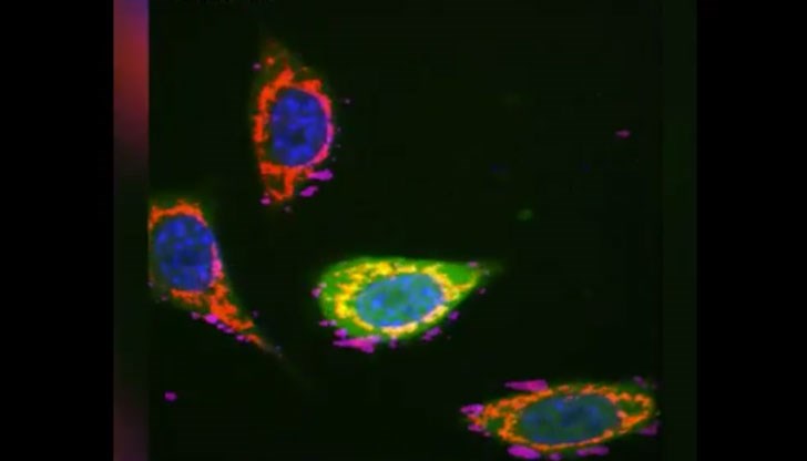 В направените изпитания методът е довел до пълно унищожаване на туморите В направените изпитания методът е довел до пълно унищожаване на туморите