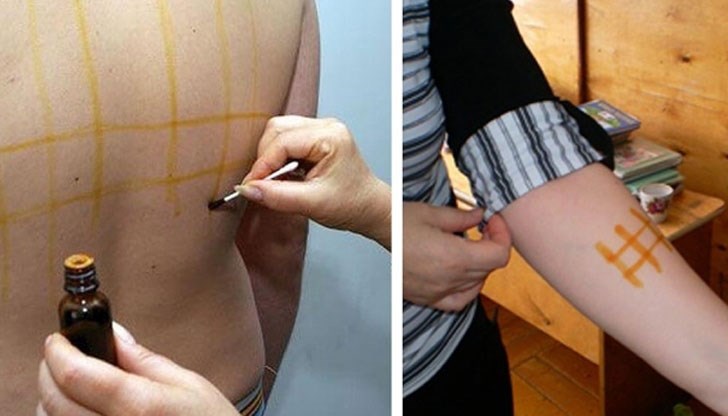 Какви са полезните свойства на йода, когато се нанася върху кожата? Какви са полезните свойства на йода, когато се нанася върху кожата?