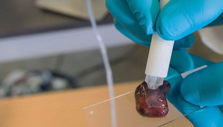 Ръчно устройство може да открие ракова тъкан за десет секунди, Ръчно устройство може да открие ракова тъкан за десет секунди,