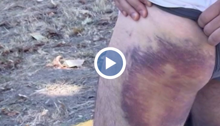 Пореден полицейски произвол в Пазарджик