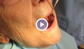 Стоматолози алармират: Няма да има безплатни зъбни протези!