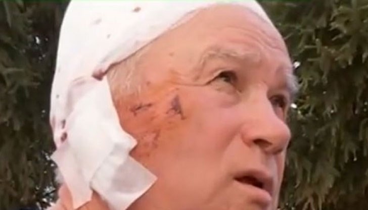 Питбул нападна 70-годишния мъж, откарват го в ИСУЛ в тежко състояние, с множество ухапвания по главата