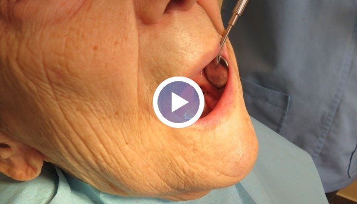 Стотици хиляди не живеят пълноценно, защото нямат пари за протези