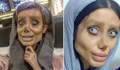 Млада жена се подложи на 50 операции, за да прилича на Анджелина Джоли