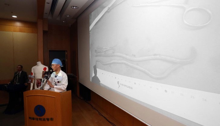 В над 20-годишната си кариера като хирург подобно нещо съм виждал само в учебниците, заяви хирург