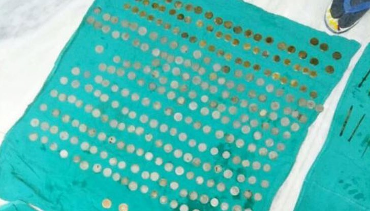 263 монети плюс пирони и гайки са извадили хирурзите