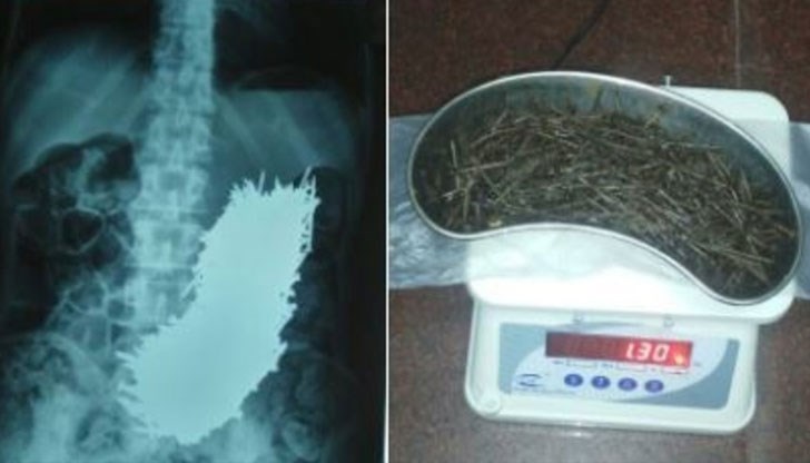 Всеки един от пироните бил с дължина 5 сантиметра