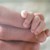 Лекари от "Пирогов" спасиха две бебета с редки аномалии