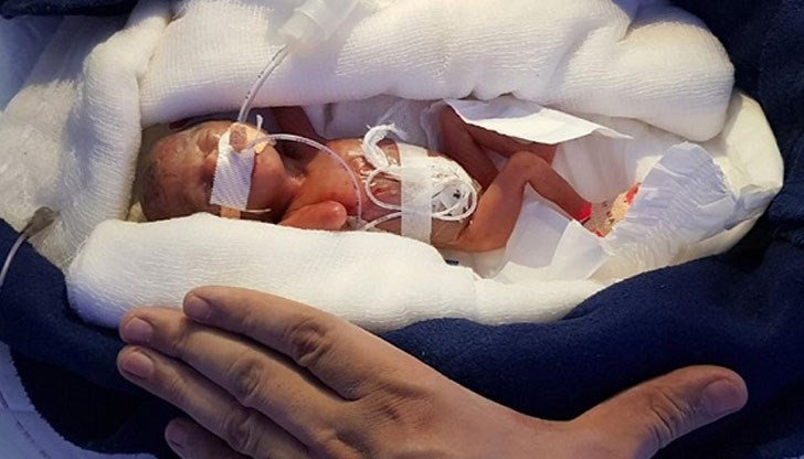 Малката Мануши се ражда 3 месеца по-рано и тежи само 400 грама