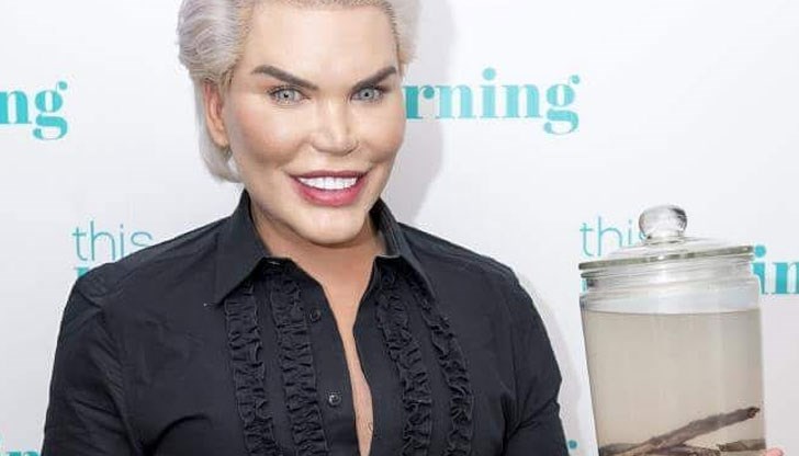 Родриго е претърпял 60 пластични операции