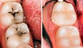 8 начина да спрем развалянето на зъбите