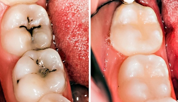 Не оставяйте четката си в тоалетната, фекалните бактерии може да се окажат в нея