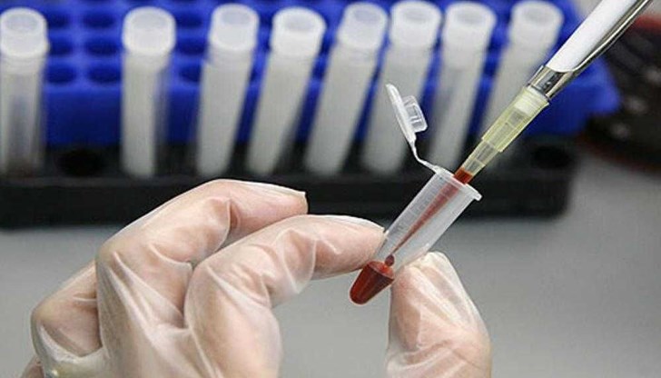 Изследването отнема максимум 5-10 минути Изследването отнема максимум 5-10 минути