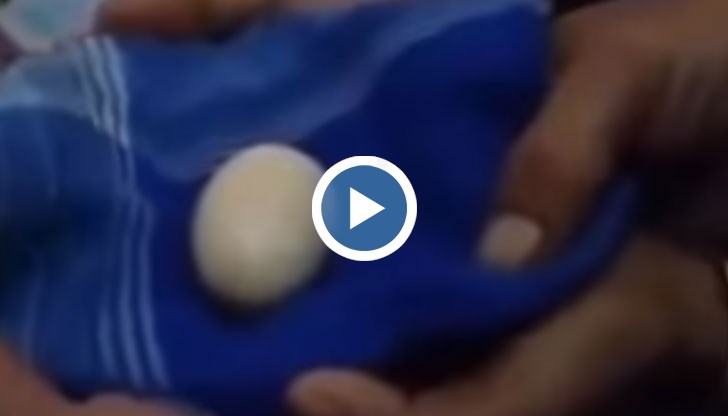 Момчето е прегледано от доктори, които не могат да проумеят феномена