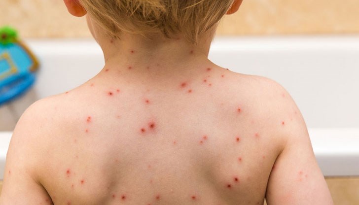 За миналата седмица в областта има регистрирани общо 15 случая