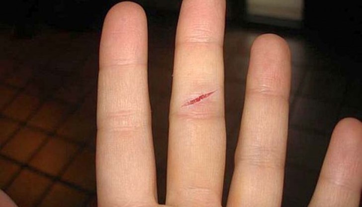 Порязването е съпроводено със силна болка, макар че нараняването е незначително Порязването е съпроводено със силна болка, макар че нараняването е незначително